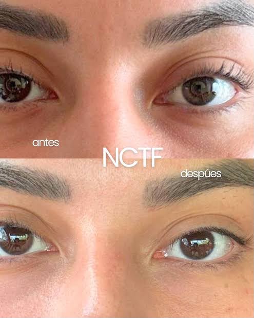 Antes NCTF