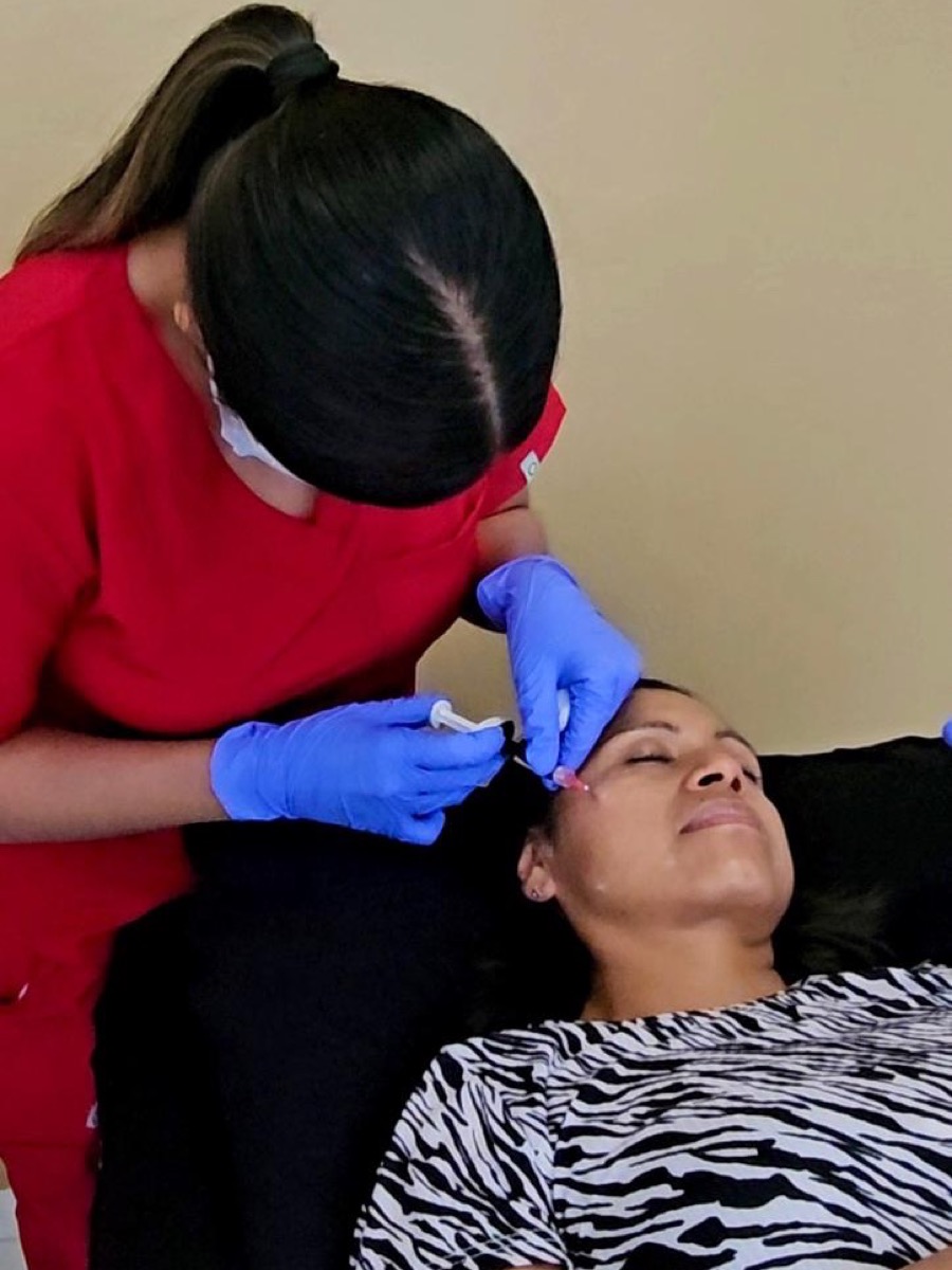 Aplicación de bioestimuladores faciales